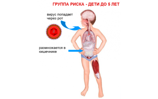 Полиомиелит - памятка для родителей, разработанная министерством образования Новосибирской области совместно с министерством здравоохранения Новосибирской области